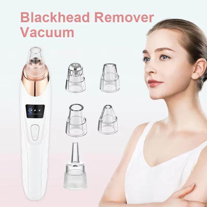 Ultimate Electric Blackhead Remover - Boost Your Skin's Glow with Powerful Suction and Exfoliation!