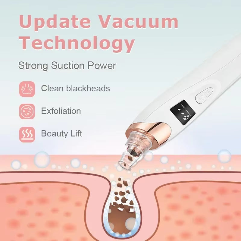 Ultimate Electric Blackhead Remover - Boost Your Skin's Glow with Powerful Suction and Exfoliation!