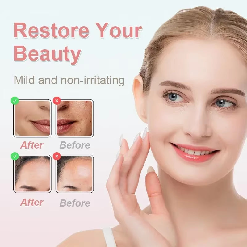 Ultimate Electric Blackhead Remover - Boost Your Skin's Glow with Powerful Suction and Exfoliation!