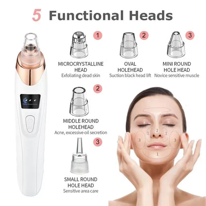 Ultimate Electric Blackhead Remover - Boost Your Skin's Glow with Powerful Suction and Exfoliation!